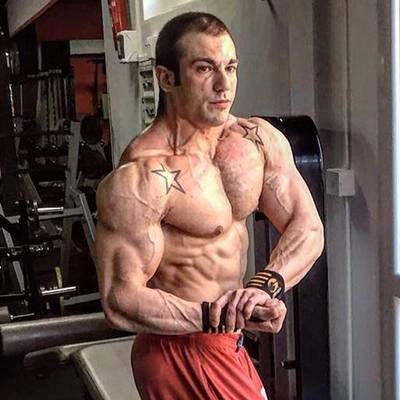 MIRKO BOTTONI