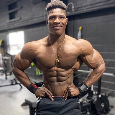 AROLDSON ETIENNE